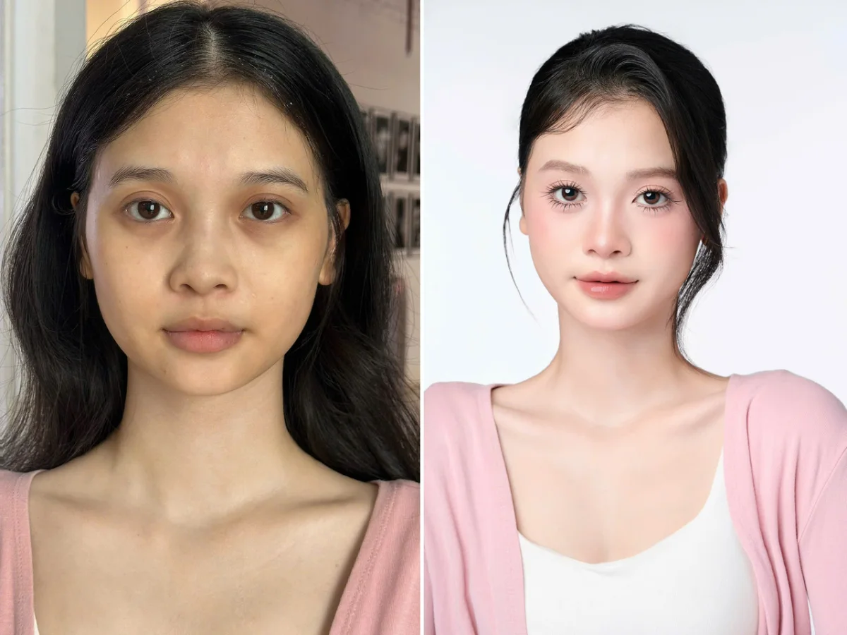 Case before / after học viên 01 của Hương Trịnh